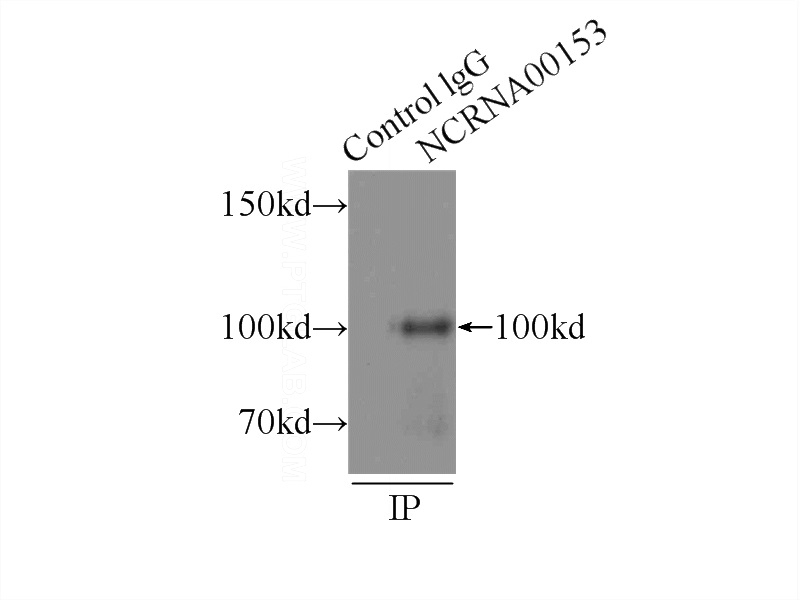 IP Result of anti-NCRNA00153 (IP:Catalog No:108696, 3ug; Detection:Catalog No:108696 1:500) with HeLa cells lysate 2000ug.