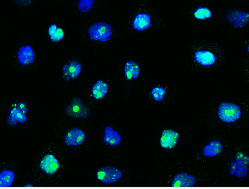 Human SIPA1 Immunofluorescence(IF) 15182