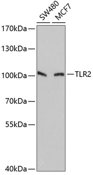 Western blot - TLR2 Polyclonal Antibody 
