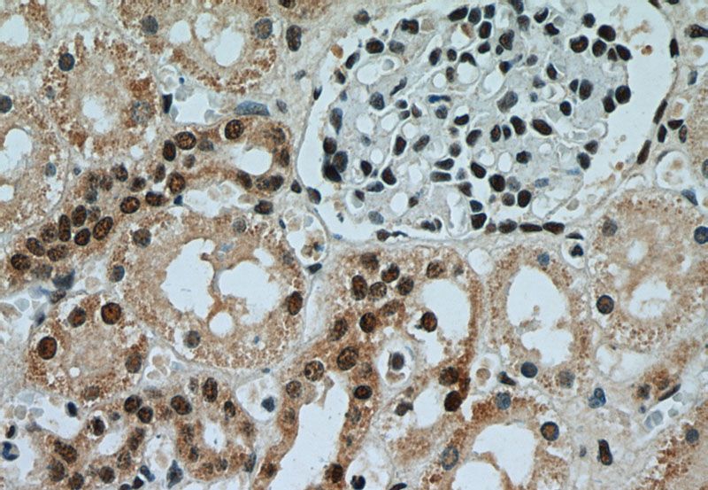 Immunohistochemistry of paraffin-embedded human kidney slide using Catalog No:108046(AQR Antibody) at dilution of 1:50