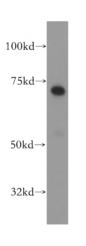 human brain tissue were subjected to SDS PAGE followed by western blot with Catalog No:114666(RHPN1 antibody) at dilution of 1:400