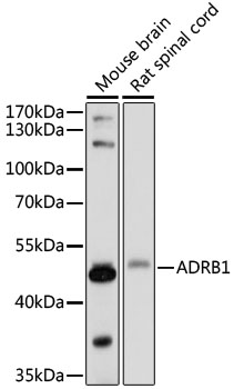 Western blot - ADRB1 Polyclonal Antibody 