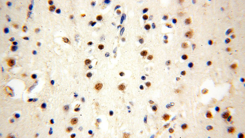 Immunohistochemical of paraffin-embedded human brain using Catalog No:116871(WDR5 antibody) at dilution of 1:100 (under 40x lens)
