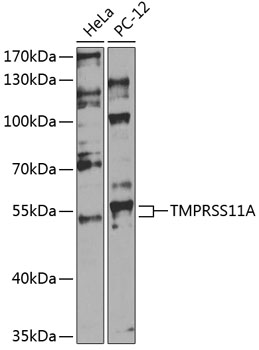 Western blot - TMPRSS11A Polyclonal Antibody 