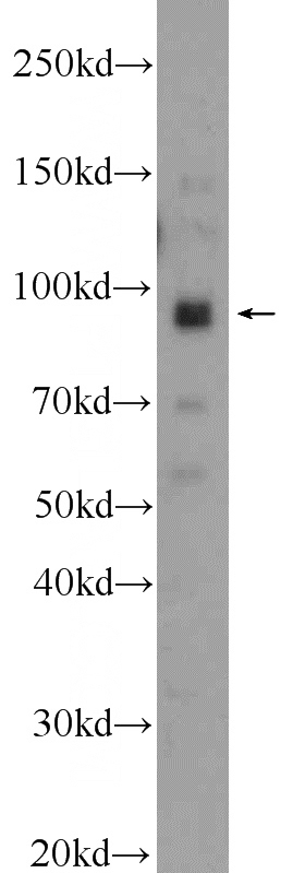 HeLa cells were subjected to SDS PAGE followed by western blot with Catalog No:112953(NARG1 antibody) at dilution of 1:300
