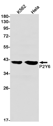 Western blot detection of P2Y6 in K562,Hela cell lysates using P2Y6 Rabbit mAb(1:1000 diluted).Predicted band size:36kDa.Observed band size:36kDa.