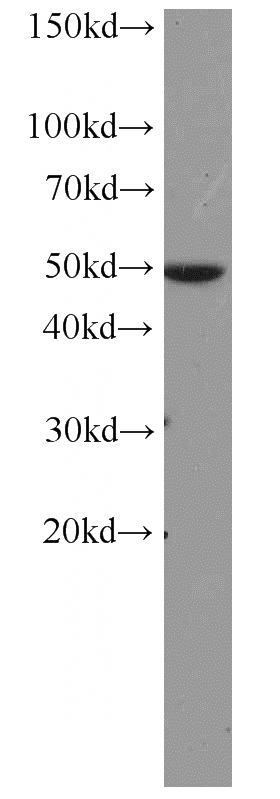 mouse heart tissue were subjected to SDS PAGE followed by western blot with Catalog No:109380(COL4A6 antibody) at dilution of 1:1000