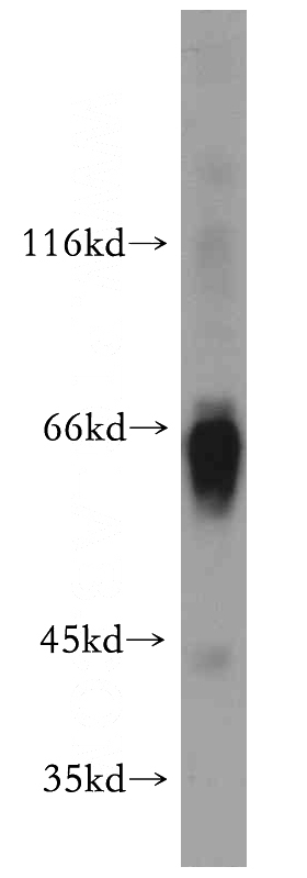human blood tissue were subjected to SDS PAGE followed by western blot with Catalog No:107861(SERPINA3,AACT antibody) at dilution of 1:500