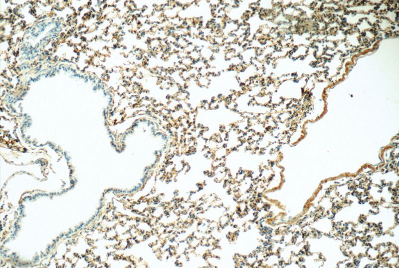 Immunohistochemistry of paraffin-embedded mouse lung tissue slide using Catalog No:111588(ICAM-1 Antibody) at dilution of 1:50 (under 10x lens)