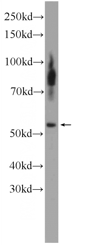 MCF-7 cells were subjected to SDS PAGE followed by western blot with Catalog No:109870(DAX-1 Antibody) at dilution of 1:300