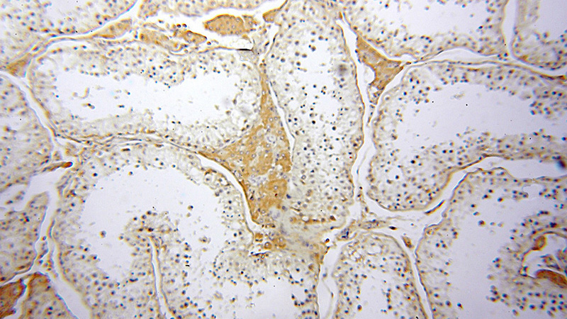 Immunohistochemical of paraffin-embedded human testis using Catalog No:115762(SYMPK antibody) at dilution of 1:50 (under 10x lens)