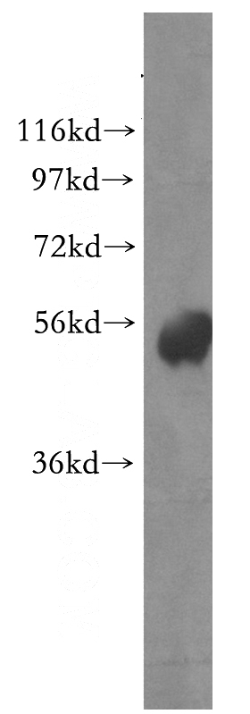 HEK-293 cells were subjected to SDS PAGE followed by western blot with Catalog No:117063(ZIPK-Phospho 311Ser antibody) at dilution of 1:1000