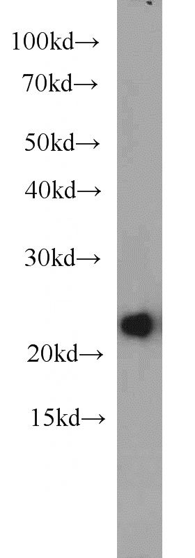 HepG2 cells were subjected to SDS PAGE followed by western blot with Catalog No:111450(HPRT1 antibody) at dilution of 1:2000