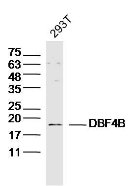 Fig1: Sample: 293T Cell (Human) Lysate at 30 ug; Primary: Anti-DBF4B at 1/300 dilution; Secondary: IRDye800CW Goat Anti-Rabbit IgG at 1/20000 dilution; Predicted band size: 18kD; Observed band size: 18kD