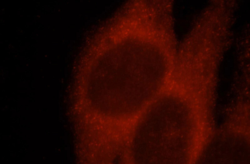 Immunofluorescent analysis of HepG2 cells, using AP1B1 antibody Catalog No:108115 at 1:25 dilution and Rhodamine-labeled goat anti-rabbit IgG (red).