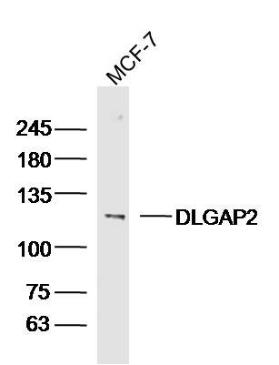 Fig1: Sample: MCF-7 Cell (Human) Lysate at 40 ug; Primary: Anti-DLGAP2 at 1/300 dilution; Secondary: IRDye800CW Goat Anti-Rabbit IgG at 1/20000 dilution; Predicted band size: 118 kD; Observed band size: 118 kD