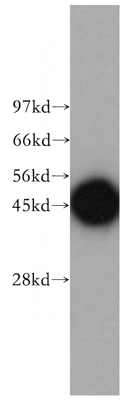 Jurkat cells were subjected to SDS PAGE followed by western blot with Catalog No:114244(PSMD6 antibody) at dilution of 1:500