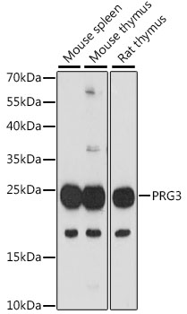 Western blot - PRG3 Polyclonal Antibody 
