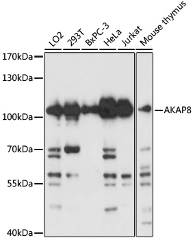 Western blot - AKAP8 Polyclonal Antibody 
