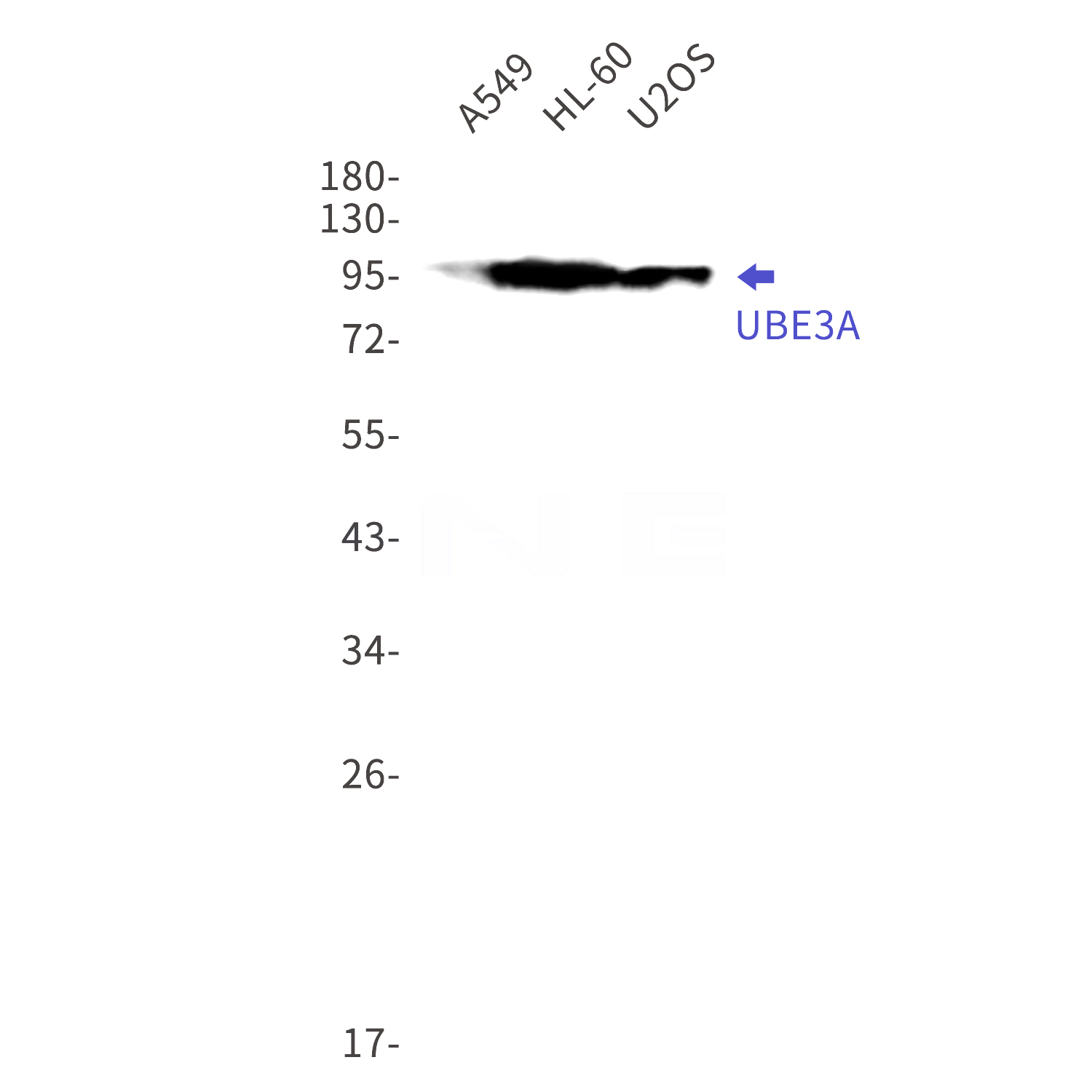 Western blot detection of UBE3A in A549,HL-60,U2OS cell lysates using UBE3A Rabbit mAb(1:1000 diluted).Predicted band size:101kDa.Observed band size:101kDa.