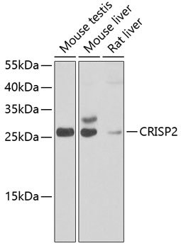Western blot - CRISP2 Polyclonal Antibody 