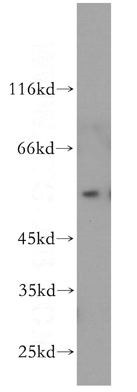 A375 cells were subjected to SDS PAGE followed by western blot with Catalog No:108057(ANGPTL3 antibody) at dilution of 1:1000