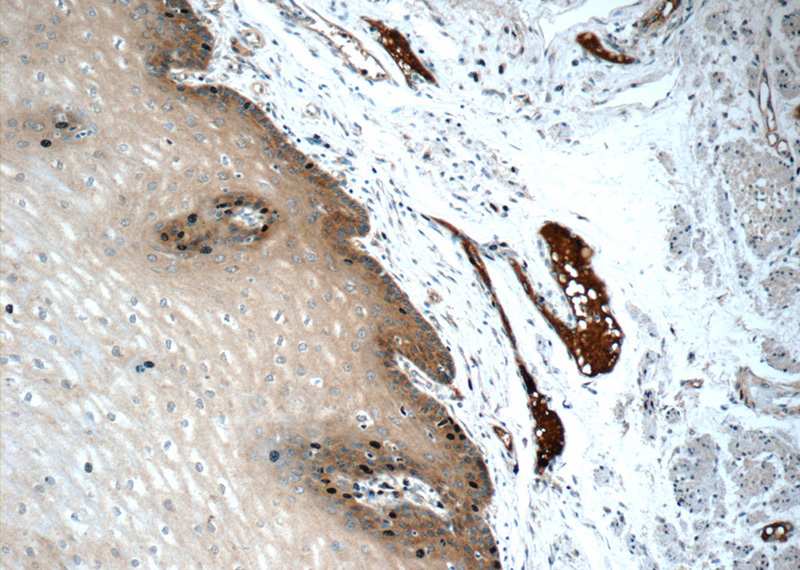 Immunohistochemistry of paraffin-embedded human oesophagus tissue slide using Catalog No:109344(CLCA2 Antibody) at dilution of 1:50 (under 10x lens)