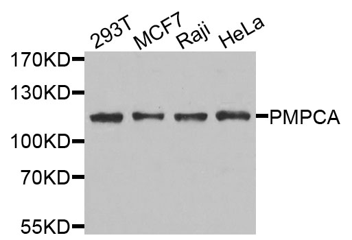 Western blot - PMPCA Polyclonal Antibody 