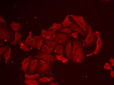 Immunofluorescence - TRPV5 Polyclonal Antibody 