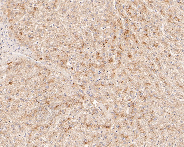 Fig3:; Immunohistochemical analysis of paraffin-embedded human liver tissue using anti-FYCO1 antibody. The section was pre-treated using heat mediated antigen retrieval with Tris-EDTA buffer (pH 8.0-8.4) for 20 minutes.The tissues were blocked in 5% BSA for 30 minutes at room temperature, washed with ddH; 2; O and PBS, and then probed with the primary antibody ( 1/500) for 30 minutes at room temperature. The detection was performed using an HRP conjugated compact polymer system. DAB was used as the chromogen. Tissues were counterstained with hematoxylin and mounted with DPX.