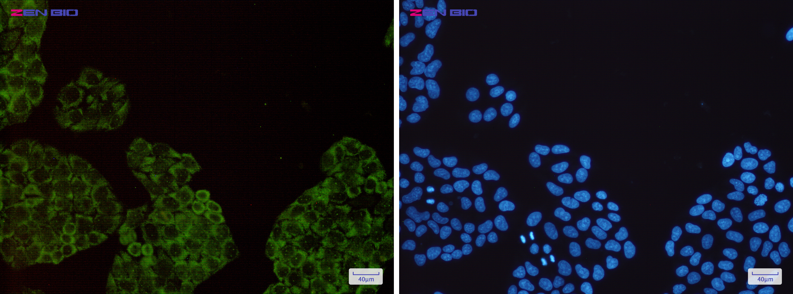Immunocytochemistry of Gemin 1(green) in Hela cells using Gemin 1 Rabbit mAb at dilution 1/200, and DAPI(blue)