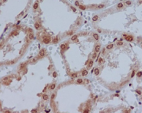 Immunohistochemical analysis of paraffin-embedded human kidney, using YB1 Antibody.