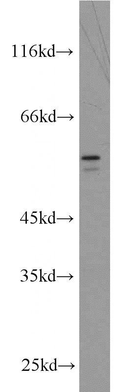 HT-1080 cells were subjected to SDS PAGE followed by western blot with Catalog No:117234(BRF2 antibody) at dilution of 1:300
