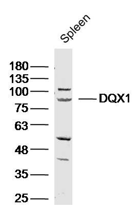 Fig1: Sample: Spleen (Mouse) Lysate at 40 ug; Primary: Anti-DQX1 at 1/300 dilution; Secondary: IRDye800CW Goat Anti-Rabbit IgG at 1/20000 dilution; Predicted band size: 79kD; Observed band size: 85kD