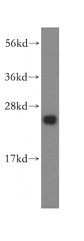 Jurkat cells were subjected to SDS PAGE followed by western blot with Catalog No:113009(N6AMT2 antibody) at dilution of 1:500