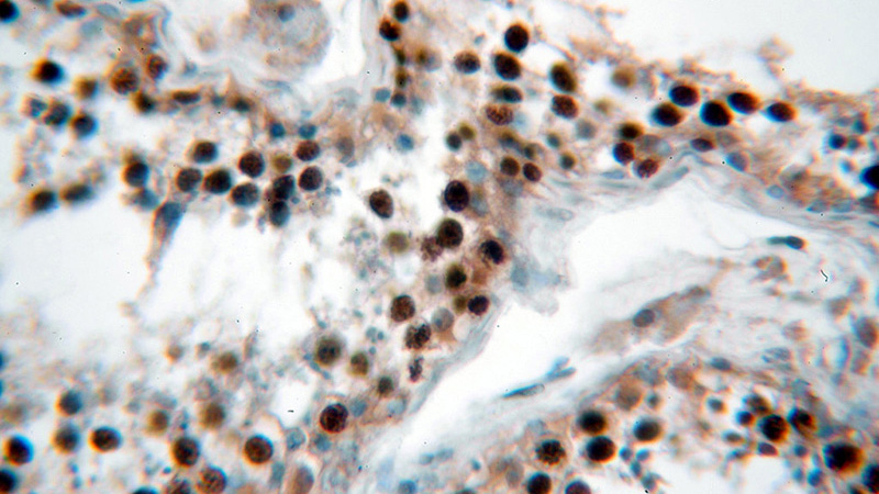 Immunohistochemical of paraffin-embedded human testis using Catalog No:110518(FANCD2-phospho antibody) at dilution of 1:50 (under 40x lens)