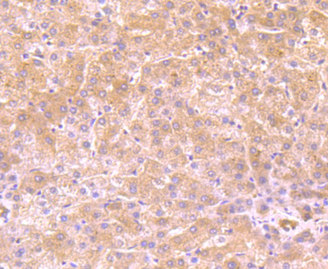 Fig3: Immunohistochemical analysis of paraffin-embedded human liver tissue using anti-FBXL18 antibody. Counter stained with hematoxylin.