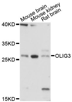 Western blot - OLIG3 Polyclonal Antibody 