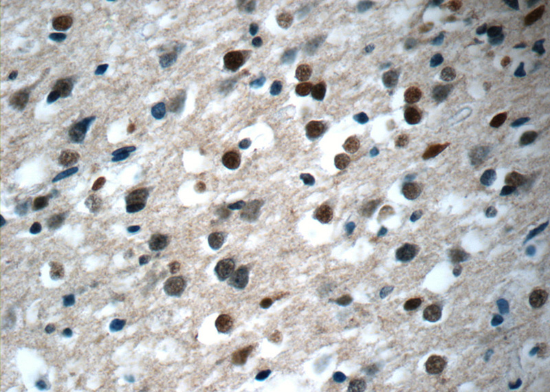 Immunohistochemistry of paraffin-embedded human brain tissue slide using Catalog No:112042(KIAA0087 Antibody) at dilution of 1:50 (under 40x lens)