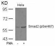 Western blot analysis of extracts from Hela cells untreated or treated with PMA using Smad2 (Phospho-Ser467) Antibody .