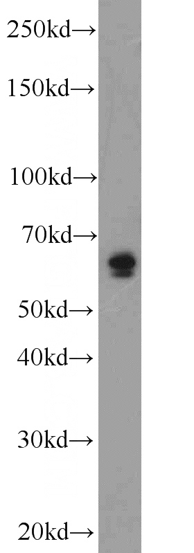 mouse brain tissue were subjected to SDS PAGE followed by western blot with Catalog No:113731(PEX5L antibody) at dilution of 1:600