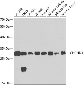 Western blot - CHCHD3 Polyclonal Antibody 