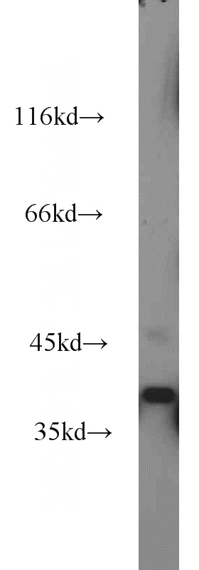 human brain tissue were subjected to SDS PAGE followed by western blot with Catalog No:116778(VPS26B antibody) at dilution of 1:1000