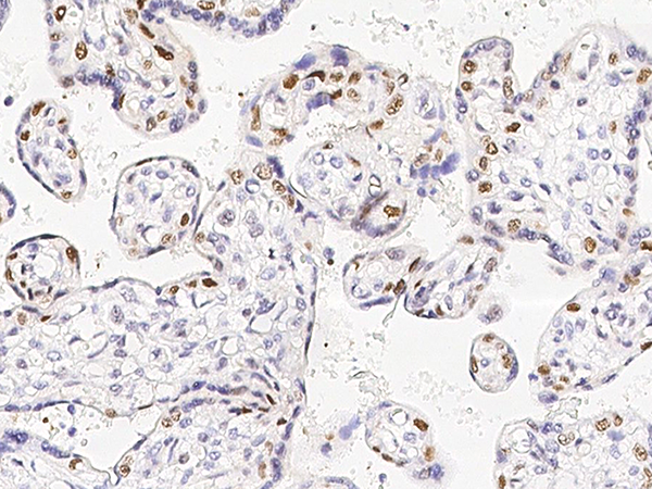 DNMT1 Antibody, Rabbit PAb, Antigen Affinity Purified, Immunohistochemistry