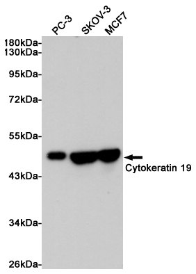 Western blot analysis of extracts from PC-3, SKOV-3 and MCF7 cells using Keratin 19 Mouse mAb at 1:1000 dilution. Predicted band size: 44KDa. Observed band size: 44KDa.