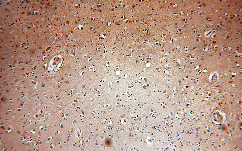 Immunohistochemical of paraffin-embedded human brain using Catalog No:112003(KIF19 antibody) at dilution of 1:50 (under 10x lens)