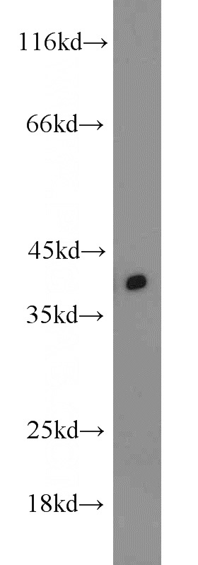 Jurkat cells were subjected to SDS PAGE followed by western blot with Catalog No:116121(DNAJA3 antibody) at dilution of 1:1000