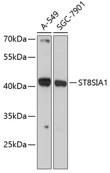 Western blot - ST8SIA1 Polyclonal Antibody 