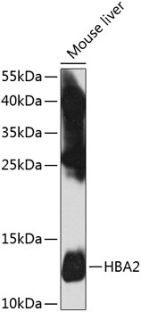 Western blot - HBA2 Polyclonal Antibody 