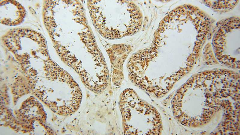 Immunohistochemical of paraffin-embedded human testis using Catalog No:111353(HIP14; ZDHHC17 antibody) at dilution of 1:50 (under 10x lens)